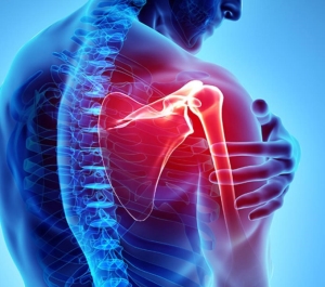Viêm quanh khớp vai – Dấu hiệu, nguyên nhân và cách điều trị