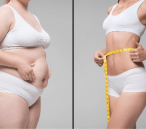 Xu hướng giảm mỡ tổng thể an toàn và bền vững năm 2025